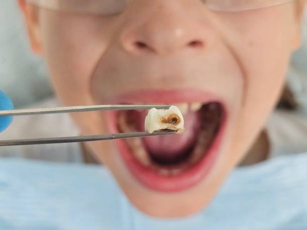 Best Pediatric Emergency Dentist in Lake Hallie, WI